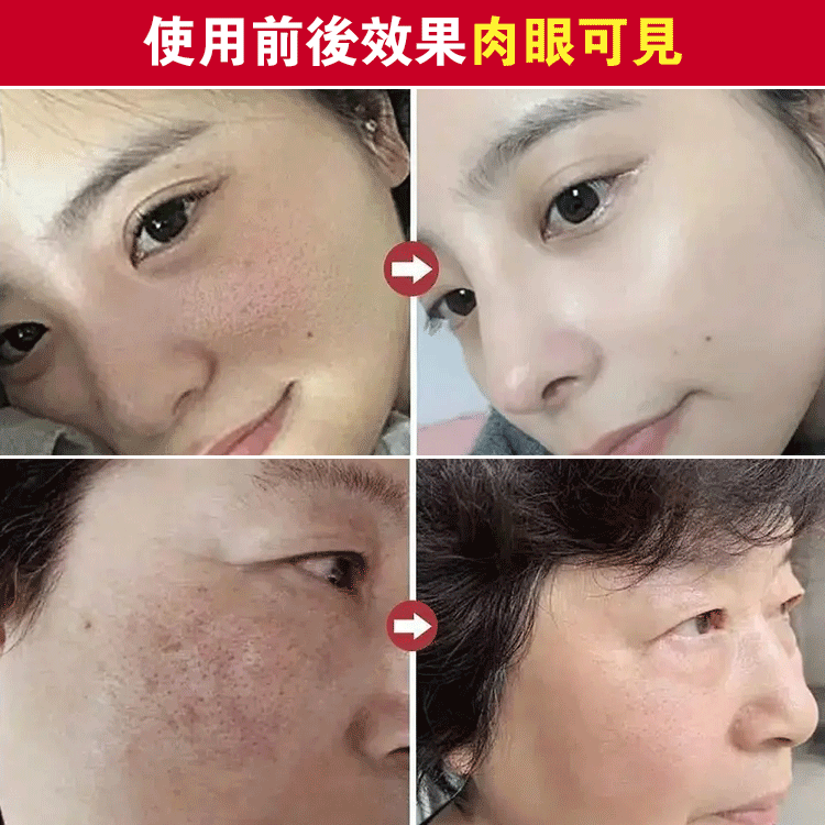 【毛孔縮縮】淨顏固體面膜 毛孔“吸麈器”,黑頭清道夫 【毛孔縮縮】淨顏固體面膜 毛孔“吸麈器”,黑頭清道夫