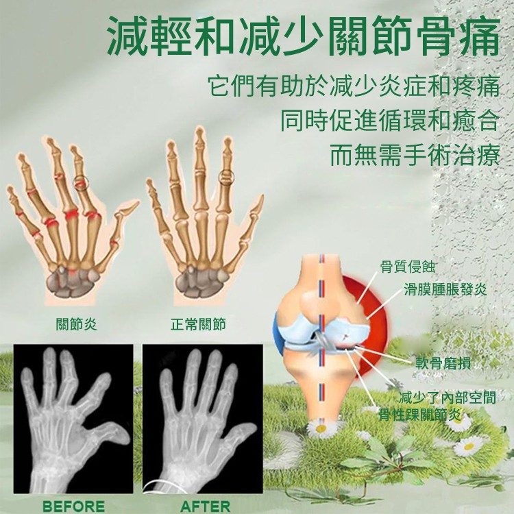 蜂毒關節霜#關節疼痛,#腫脹,全面護理 塗一塗告別疼痛 ☑損傷疼痛☑腫脹變形☑風濕骨痛 蜂毒關節霜#關節疼痛,#腫脹,全面護理 塗一塗告別疼痛 ☑損傷疼痛☑腫脹變形☑風濕骨痛